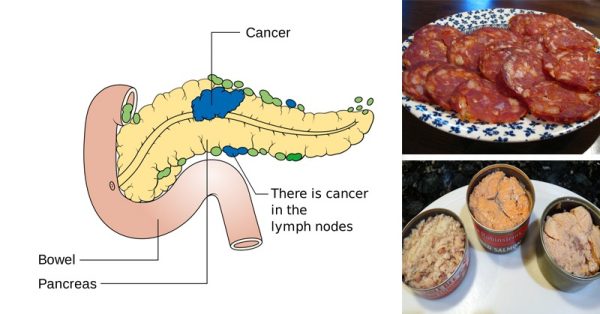 HE. 10 CANCER-Causing Foods, You Should Never Put in Your Mouth Again!