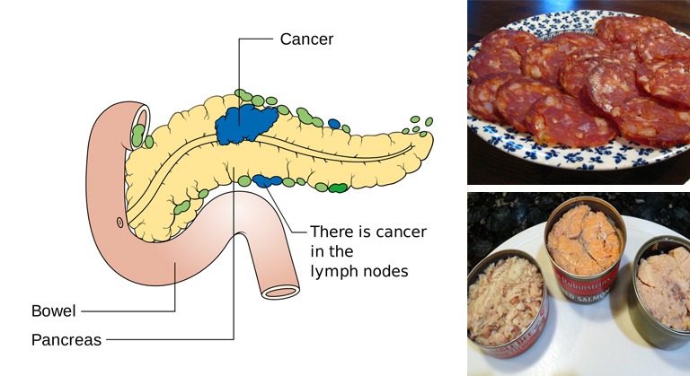 HE. 10 CANCER-Causing Foods, You Should Never Put in Your Mouth Again!