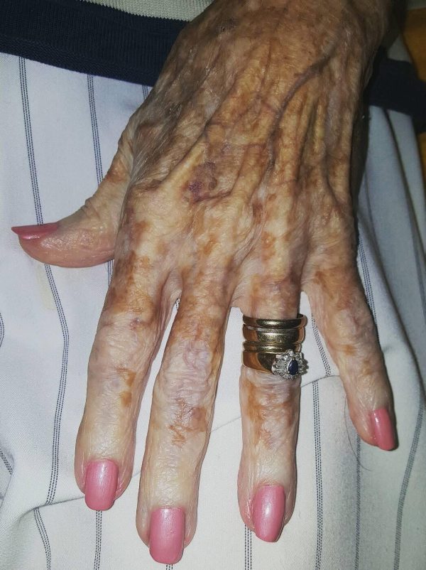 HE. Nurse takes photo of old lady’s hand – then sees detail in the picture that has the internet exploding