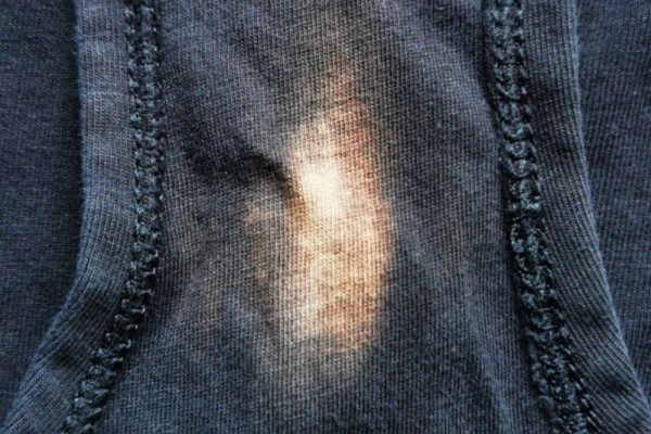 HT6. Noticed a “Bleach” Patch on Your Underwear? You better know what it means…