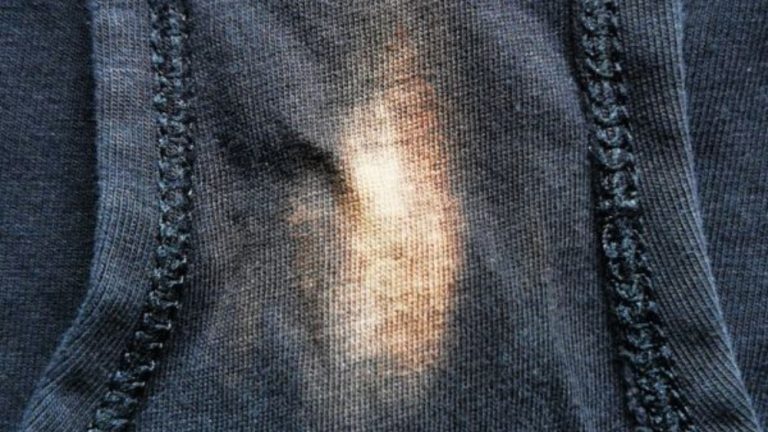 HT6. Noticed a “Bleach” Patch on Your Underwear? You better know what it means…