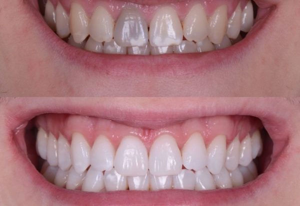 ST6. 10 Best Methods To Keep Your Teeth Healthy 