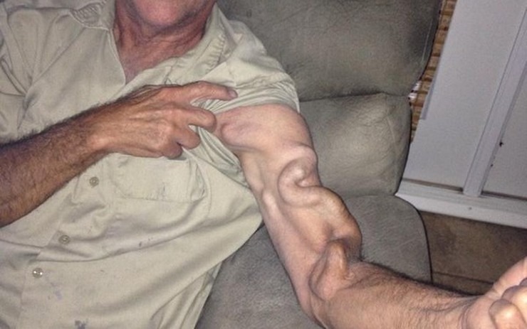 HT17. A Man Goes to Stretch and Ends Up Feeling a Sharp Pain in His Arm, It Was a Case That Shocked Everyone
