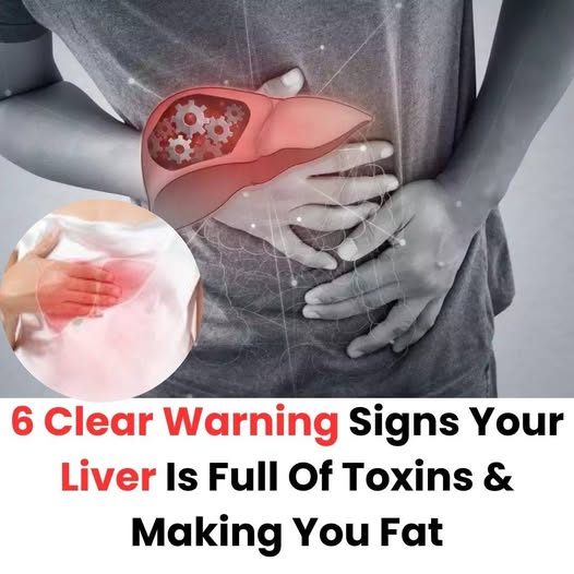 HT17. 6 Clear Warning Signs Your Liver Is Full Of Toxins & Making You Fat