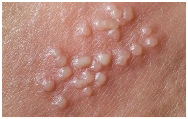 HT17. Warning signs you should never ignore on your skin