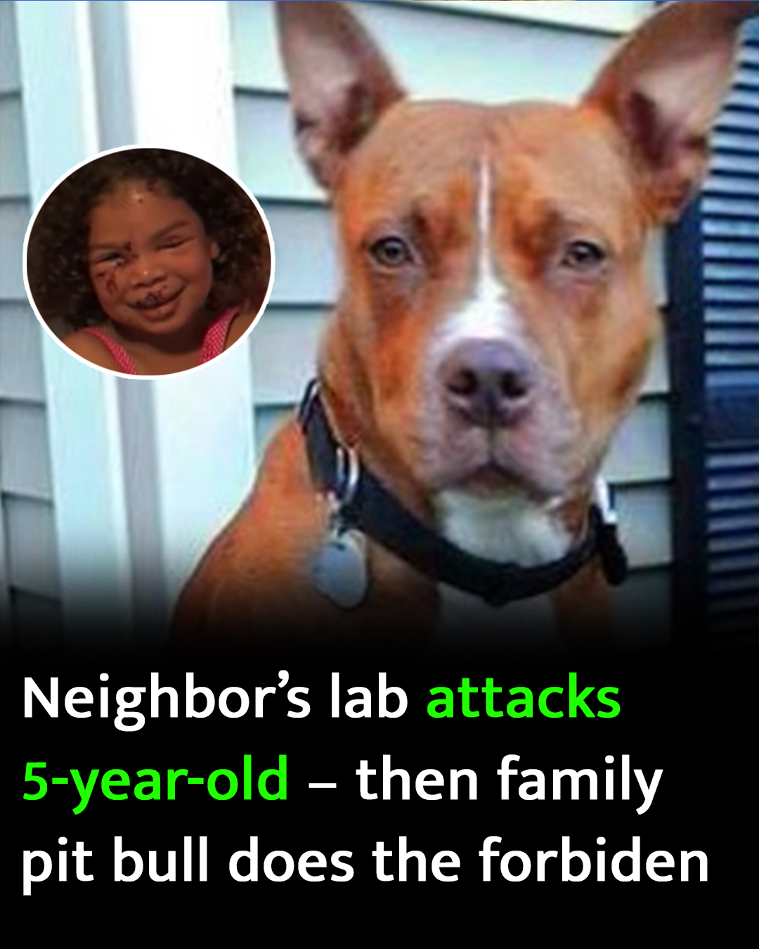 AN. 5-year-old gets bitten by neighbor’s labrador – this sets off the family pit bull who does the unimaginable